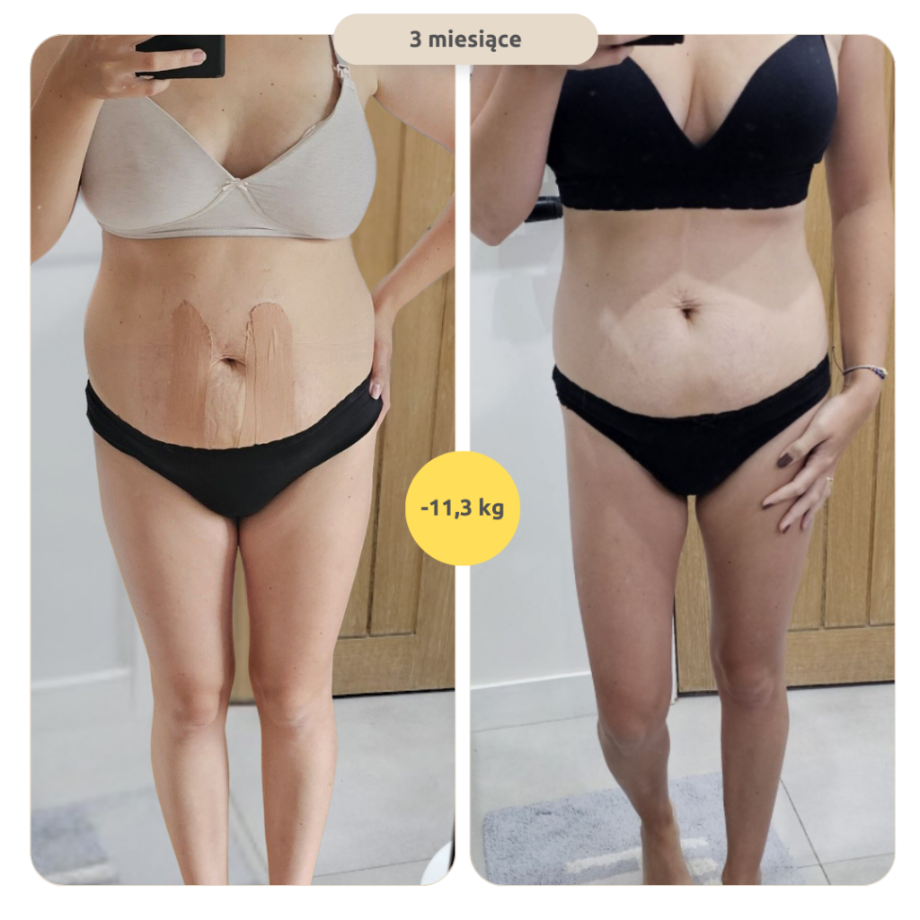 metamorfoza podopiecznej