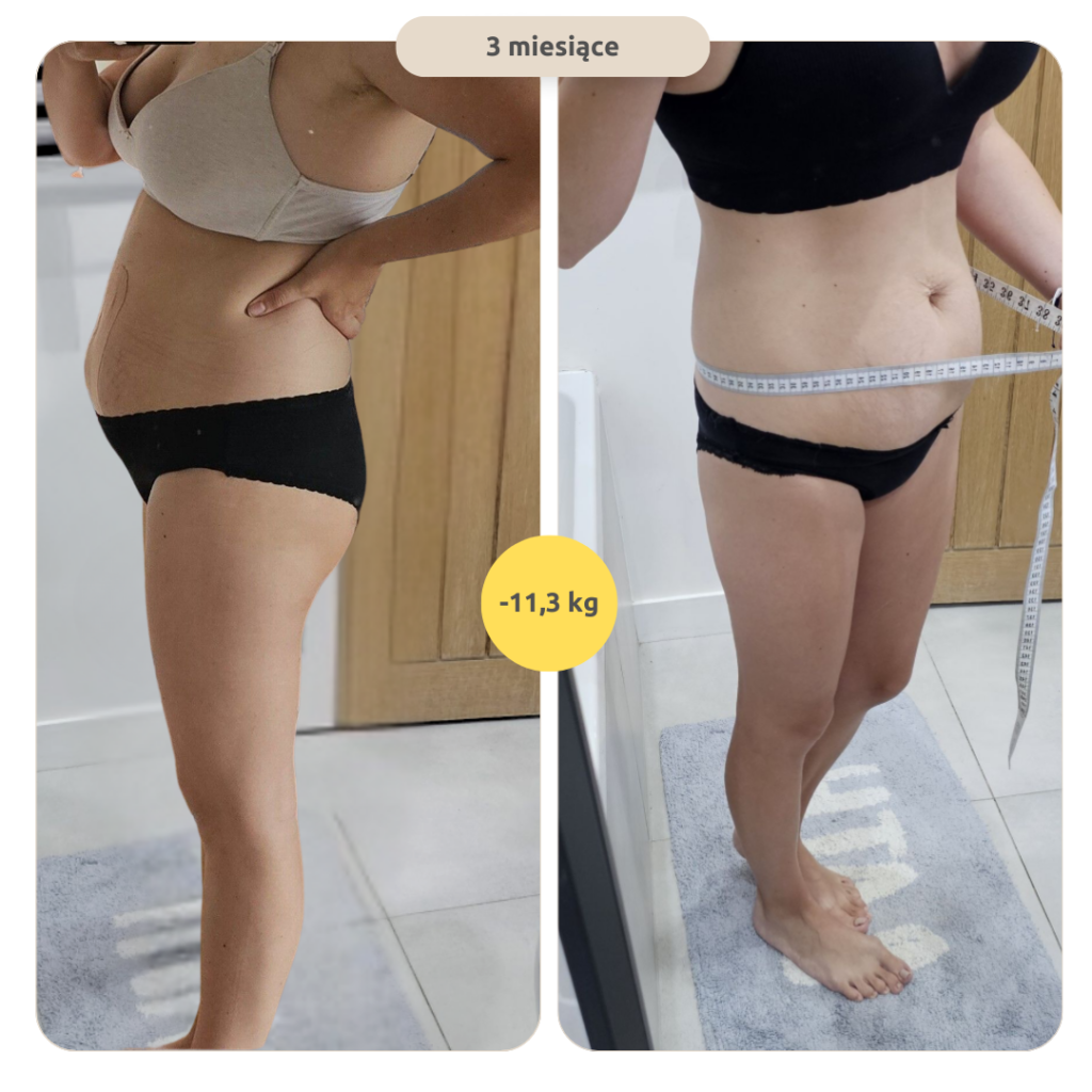 metamorfoza podopiecznej